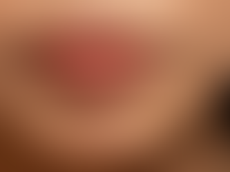 Achieving Perfect Lips with Natural Lip Enhancement