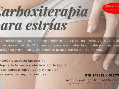 Carboxiterapia para estrías