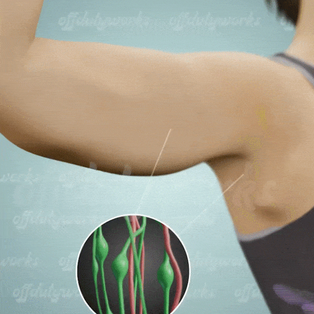 linfaticos1gif-min.gif