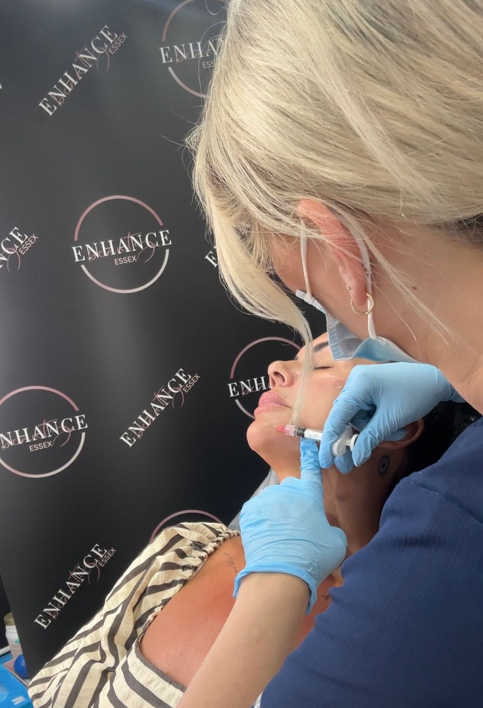profhilo skin booster