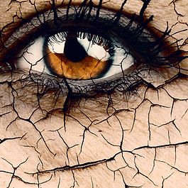 Dry eye is a common condition where the eyes don’t produce enough tears or the tears evaporate too quickly, leading to discomfort, irritation, and sometimes blurry vision.