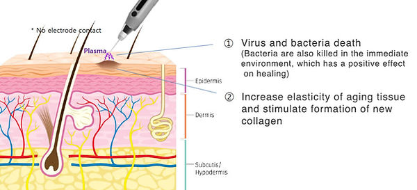 plaxel-plasma-pen-effects-on-skin.jpg