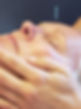 Facial Acupuncture Treatment for Healthy Aging