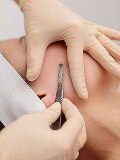 DermaplaneTraining-Sligo.jpg