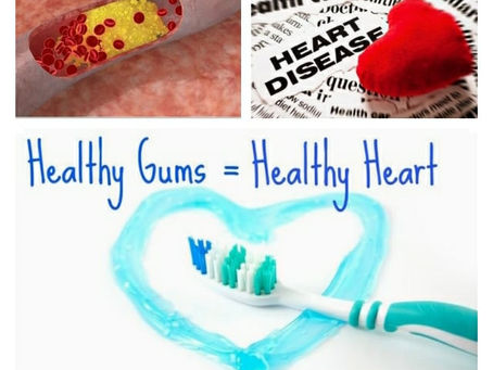 השפעת מחלת חניכיים על תפקוד הלב