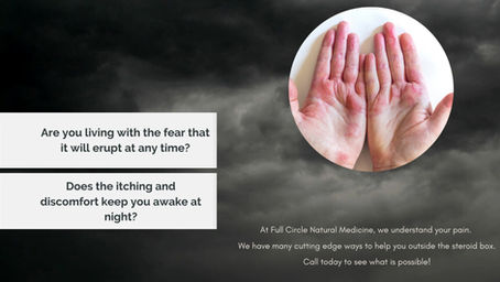 We have a program to set you FREE from Eczema