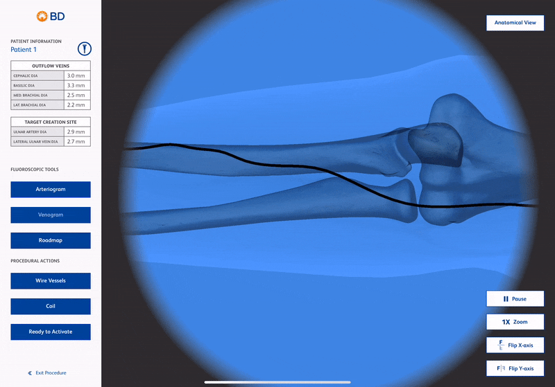 BD_Fluoro.gif