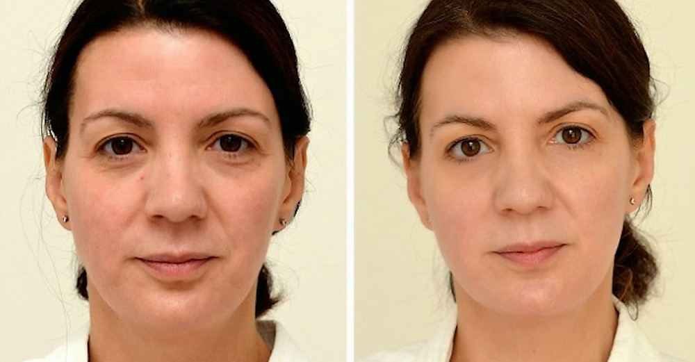 This Woman Drank 3 Liters Of Water A Day. Her Final Results Shocked Everyone!