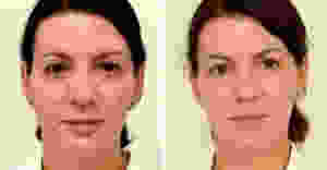 This Woman Drank 3 Liters Of Water A Day. Her Final Results Shocked Everyone!