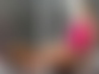 A prática exagerada de musculação é um dos fatores para o aparecimento de varizes