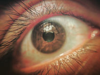 close up photo of eyeball
