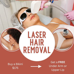 LeDerm Laser Vein Removal