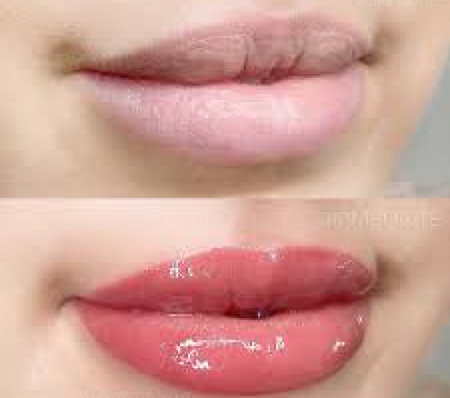 Lip rejuvenation and detox at qnailsandspa
