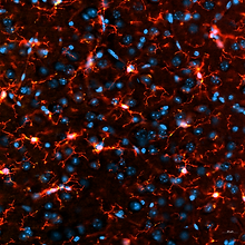Iba1-CD68-Staining-Wako-Test_h0t0z0c0-3x0-2586y0-2586.tif