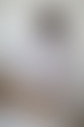 L’épilation laser en France : ce que dit la nouvelle réglementation (et où faire confiance à Paris 16)