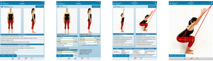 How does Posture relate to Your Health 1 c64552 a2381a31708e4455a4b9f3cbecf5c3f5~mv2
