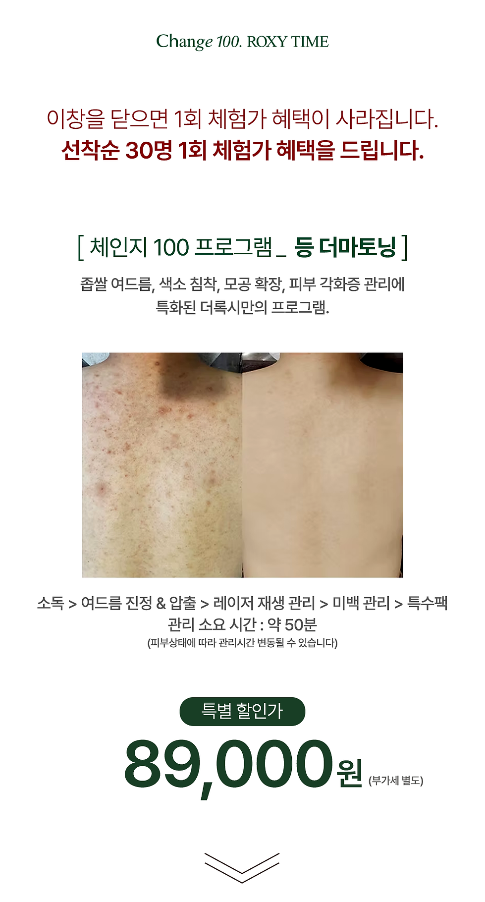 등 더마토닝 상단.png