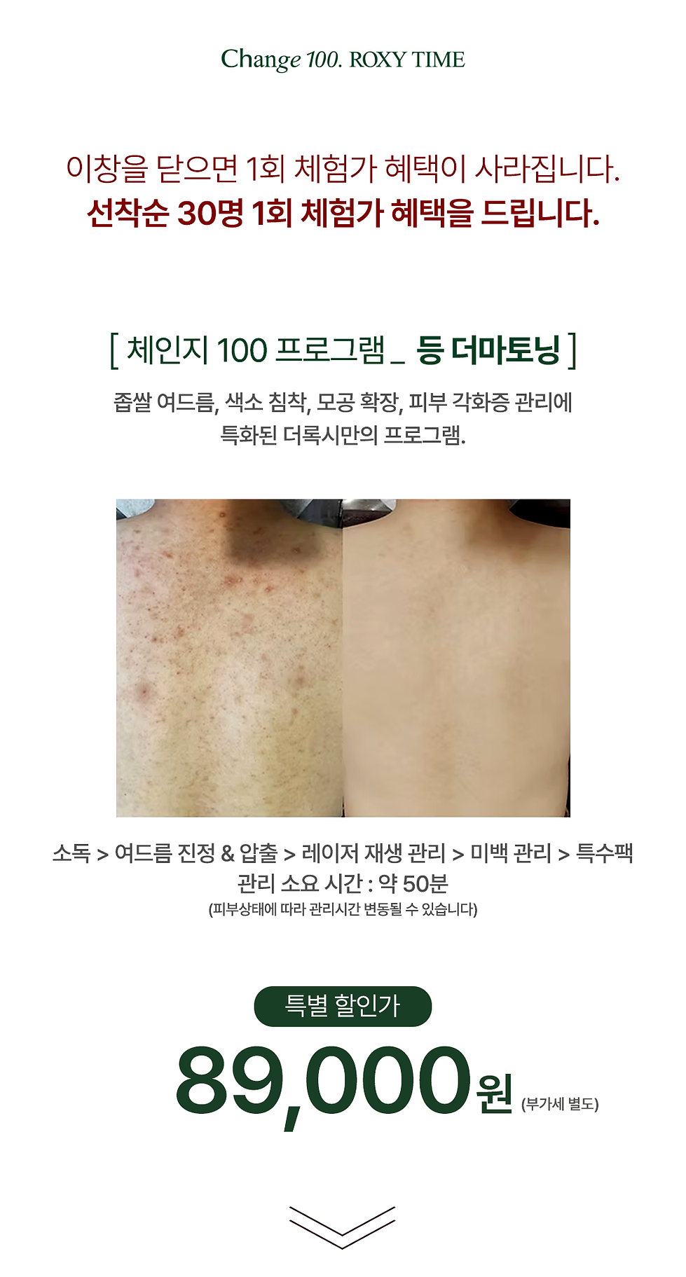 등 더마토닝 상단.png