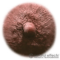 Paramedica micropigmentation medical tattoo
