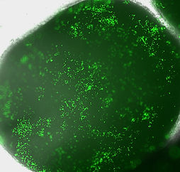 COA49-RCMB20-tumor-organoid-1-082025_0002_overlay_edited.jpg