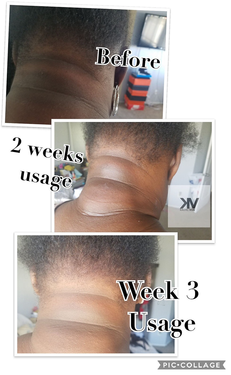 Thumbnail: Pretty Skin (skin correction cream)