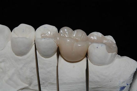 Mady Dental lab