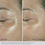 Thumbnail: OBAGI ELASTIDERM EYE CREAM
