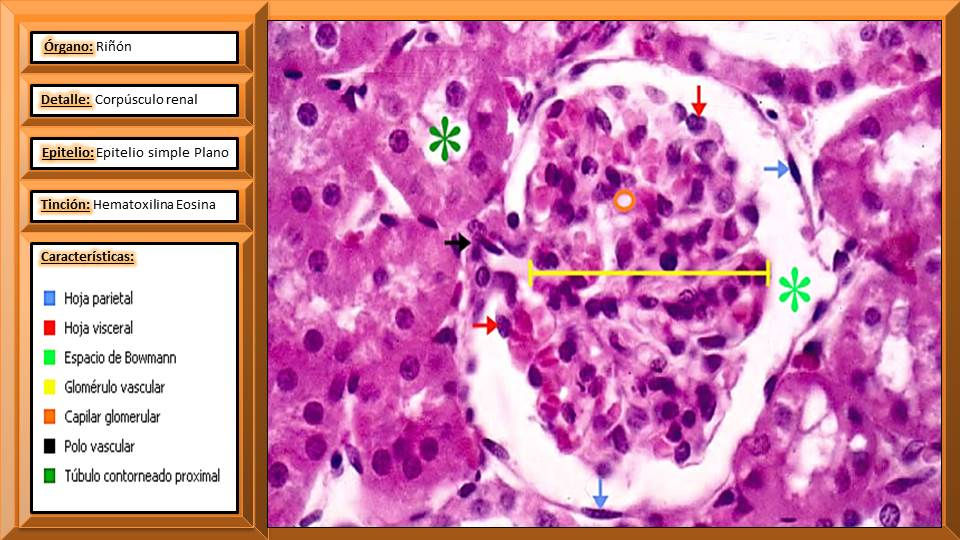 Epitelio simple plano - corpusculo renal.JPG