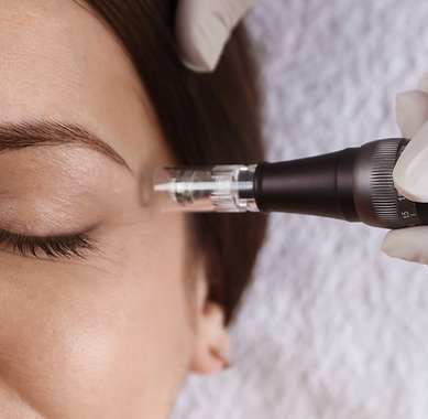 Microneedling Dr Julia Sen Worcester.png