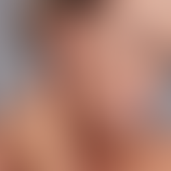 Dr Julia Loves ... ICONA® H8 Skinboosters