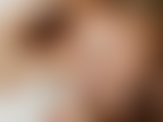 Lifting The Lid On Blepharoplasty Surgery