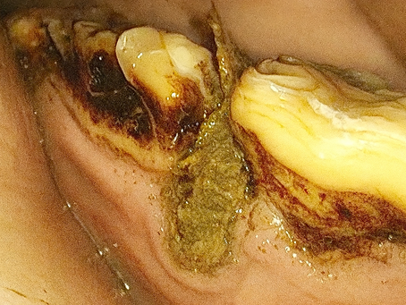 The 30-second rinse that could save your horse's teeth (and your wallet)