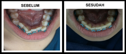 Orthohasil1_edited.png