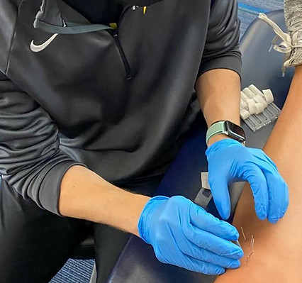 dryneedling.jpg