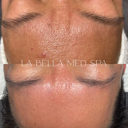 Skin texture