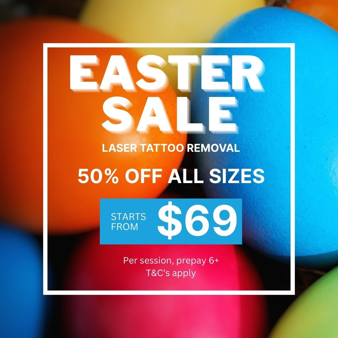 LASER TATTOO REMOVAL EASTER SALE