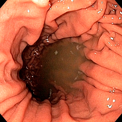 Estomac (fundus) normal