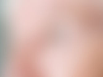 Você já ouviu falar na DMRI - Degeneração Macular Relacionada à Idade?