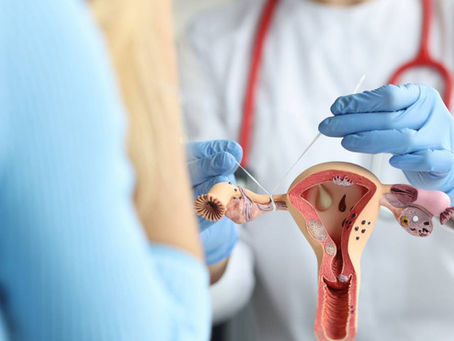 Nova Lei da laqueadura traz grande avanço no direito das mulheres