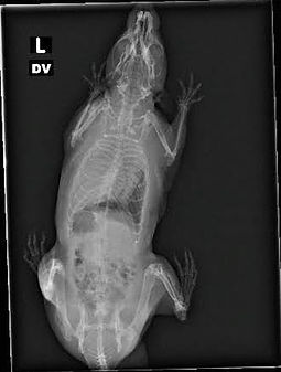 pneumonia xray bento (3).jpg