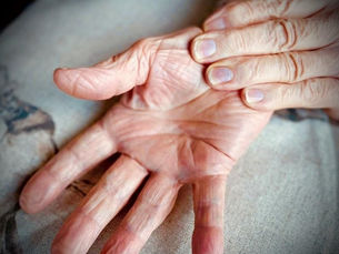 Carpal Tunnel Syndrome – What you need to know