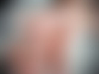 Carpal Tunnel Syndrome – What you need to know