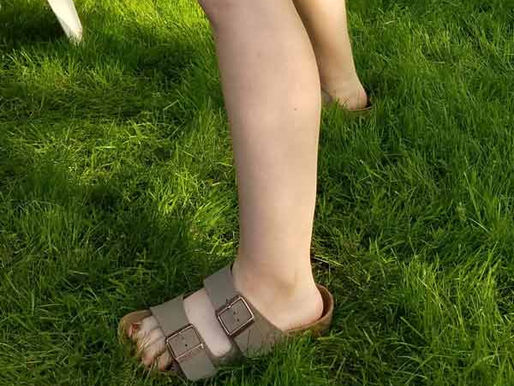 What are ‘cankles’?