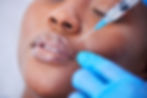 Close-up of a person getting a lip injection. A hand in blue gloves holds a syringe near the lips. Calm expression, neutral background.