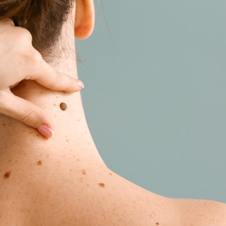 Dermatologist examining moles of patient on grey background.jpg