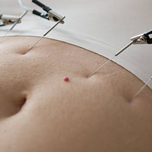 ELECTROLIPO3-1024x1024.jpg