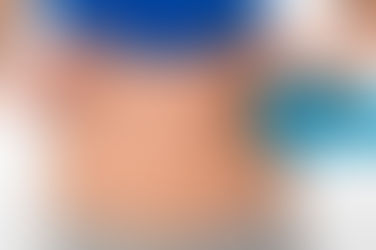 من Flab إلى Fab: الدليل النهائي لقصص نجاح جراحة شفط الدهون