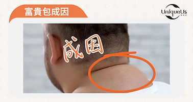 個案 POST (6)_edited.jpg