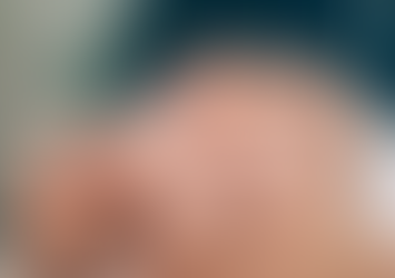 Discover the Benefits of Lymphatic Facial Massage in Sydney