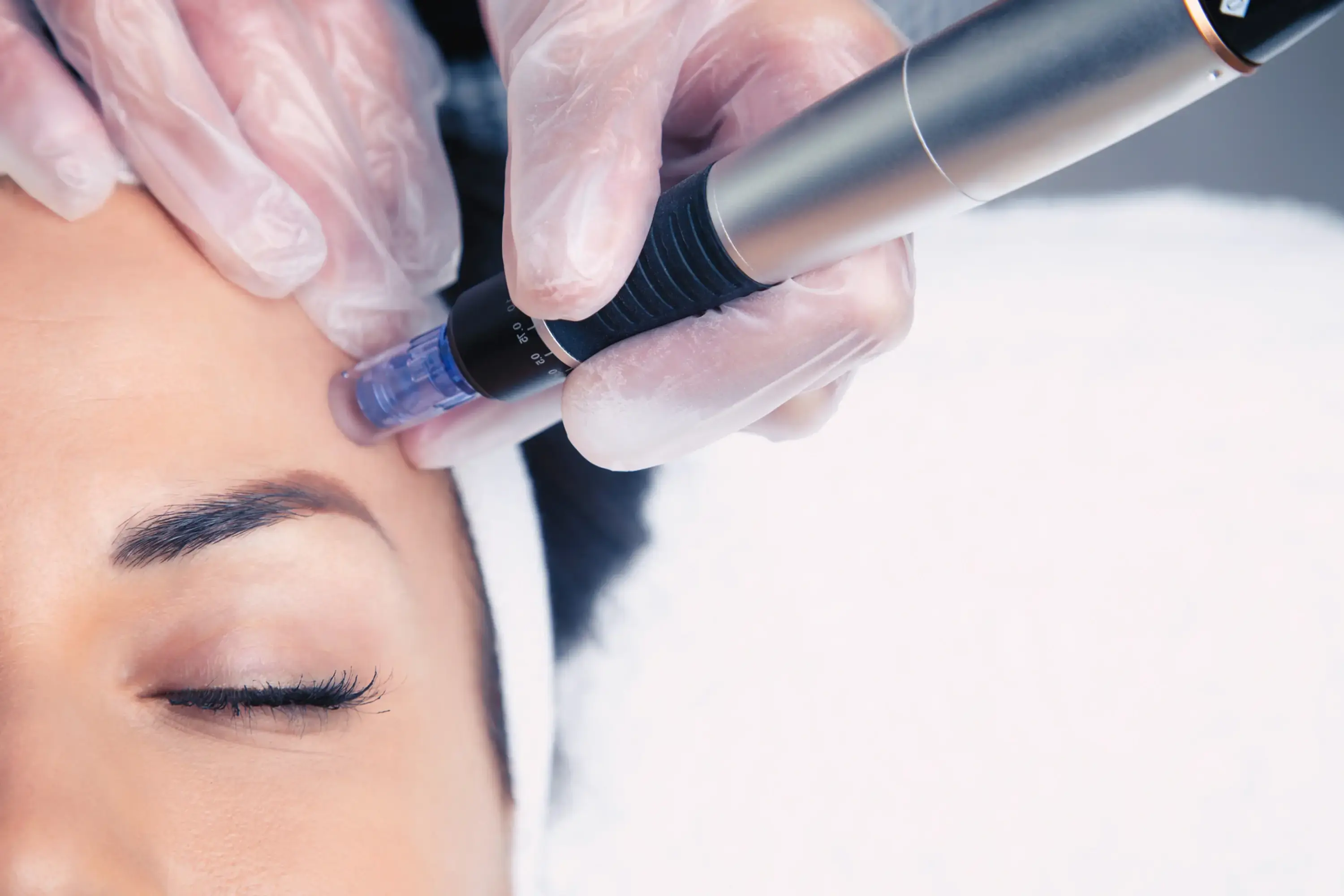 Microneedling Dermapen 4 pour booster le collagène